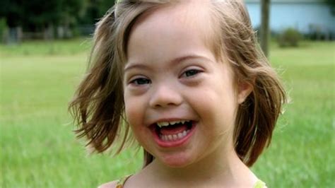 The T Of A Child With Down Syndrome Familiesfullyalive
