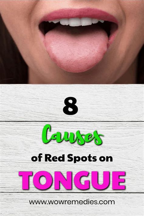 Red Spots On Tongue Causes And Treatment Bumps On Tongue Tongue