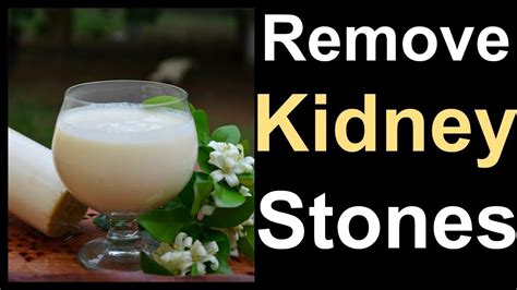 Remove Kidney Stones Naturally With This Miracle Drink Home Remedy