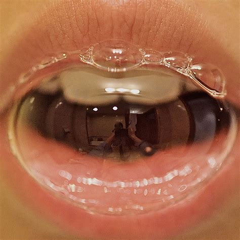 Hipersalivación O Exceso De Saliva: Causas, Síntomas Y Tratamiento - La