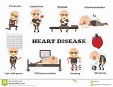 Pictures of Cardiovascular Disease Symptoms And Treatment