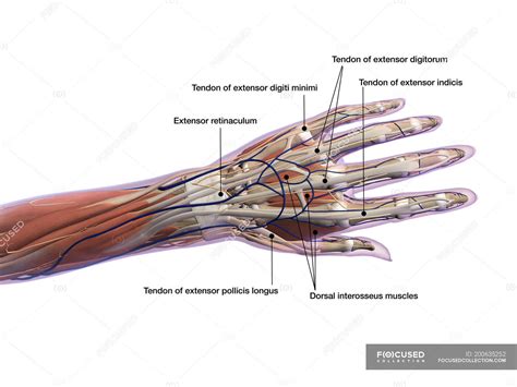 Tendon Diagram Hand Tendon Transfers Of The Hand Florida Orthopaedic