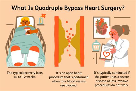 Quadruple Bypass Heart Surgery Process And Recovery 2022