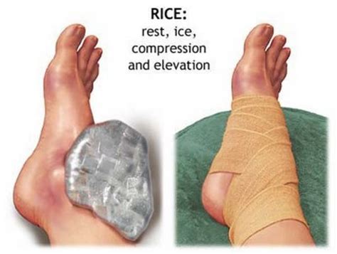 👉 Sprained Toe Symptoms Vs Broken Big Toe Treatment December 2021