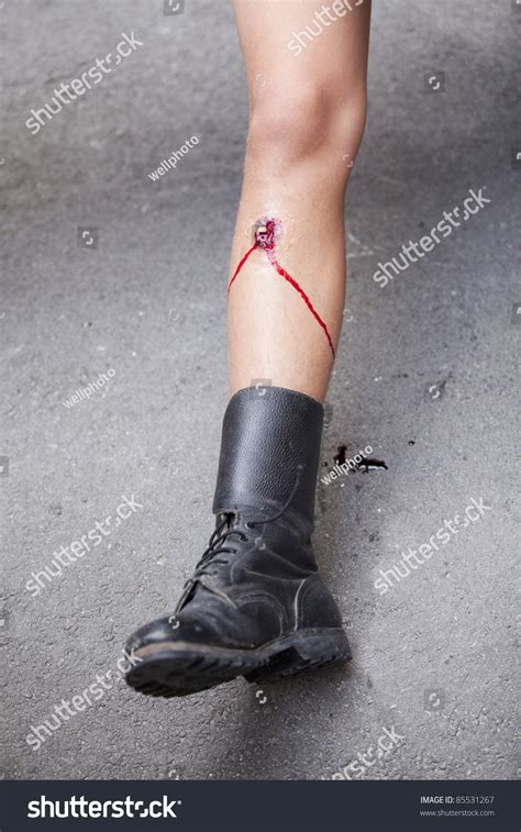Gunshot Wound On Mens Leg Stock Photo Edit Now 85531267