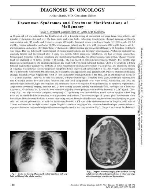 Pdf Uncommon Syndromes And Treatment Manifestations Of Malignancy