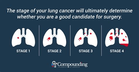 What Does It Mean If My Lung Cancer Is Inoperable