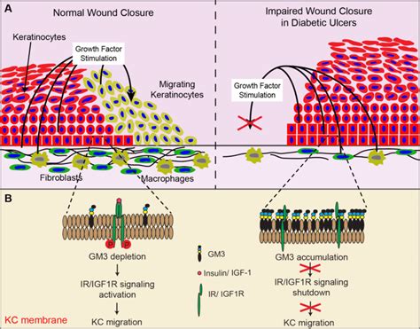 Comparing Diabetic Wound Healing To Normal Wound Healing A Diabetic