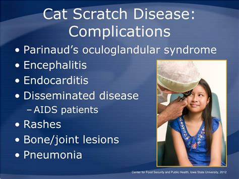 Ppt Cat Scratch Disease And Other Bartonella Infections Powerpoint