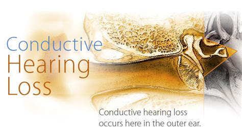 Conductive Hearing Loss Luebbe Hearing Services