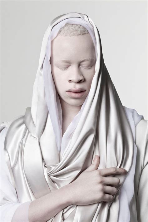 Stunning Photos Of Models With Albinism Capture The Beauty In Breaking