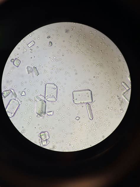 Types of crystals in cat urine. Struvite crystals from a cats urine sample | Medic ...