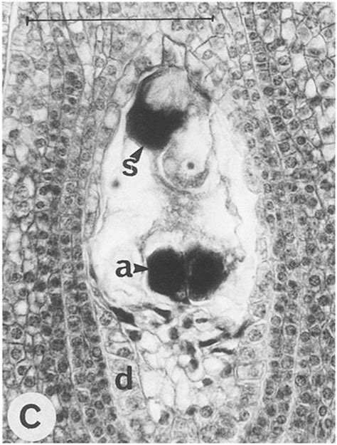 Lomandrareae Ovule Sections At Anthcsis A D Cross Sections Of