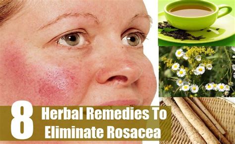 Herbal Remedies To Eliminate Rosacea Herbal Remedies Natural Rosacea