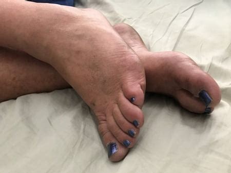 Porn Pics BBW Wife Belly Betty Dirty Feet And Panties 312944126