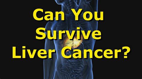 Can You Survive Liver Cancer Liver Cancer Survival Statistics Youtube