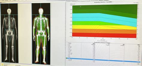 How Much Dexa Body Scan Costs And Is It Worth It Azure Medical