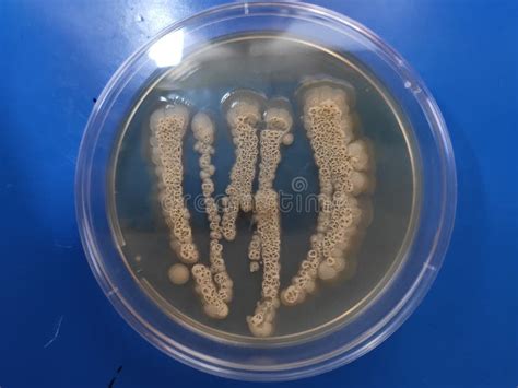 Candida Albicans Creciendo Sobre El Medio Agar Sabouraud Dextrose