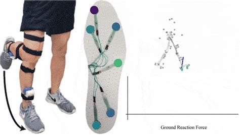 Low Cost Sensor Equipped Insole Todays Medical Developments