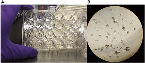Organoid Plating Examples In 24 Wells Plates A And B As Shown In A