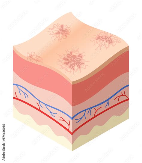 Skincare Medical Concept Problems In Cross Section Of Human Skin