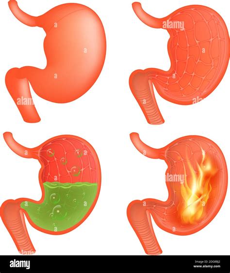 Vector Medical Illustration Of Realistic Stomach Outside And Inside