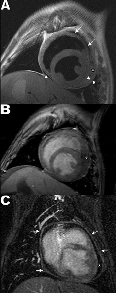 Figure 1 From Cardiac Mri Findings In A Dog With A Diffuse Pericardial