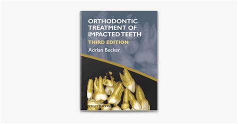 ‎orthodontic Treatment Of Impacted Teeth By Adrian Becker Ebook