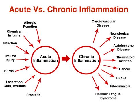 Inflammation Types Causes Symptoms And Properties
