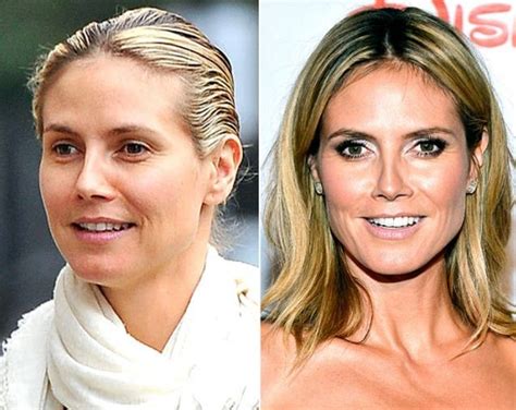 Heidi Klum Before And After Plastic Surgery 30 Celebrity Plastic