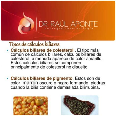 Raúl Aponte Rendón on Twitter Tipos de calculos biliares