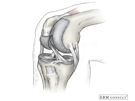 Related online courses on physioplus. Anatomy: Knee