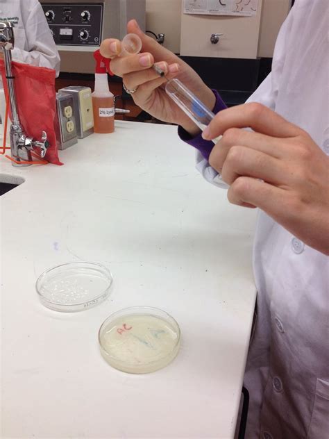 Rose And Lindseys Medical Microbiology Blog Starch Hydrolysis Test