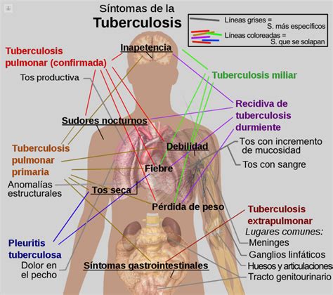 Tuberculosis qué es síntomas y tratamiento Top Doctors