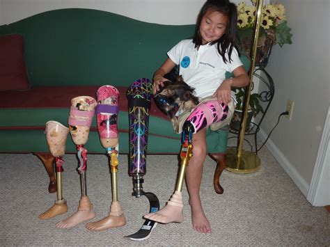 Image Result For Prosthetic Leg Child Prosthetic Leg Amputee Model