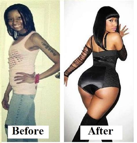 Nicki Minaj Before And After Before And After Pinterest Plastic