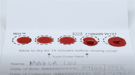 8 Things You Need To Know About Dried Blood Spot Testing Blog Ash