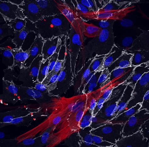 Method To Derive Blood Vessel Cells From Skin Cells Suggests Ways To