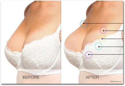 Get A Bigger Bust And Increase Breast Size Without Surgery With Bolero