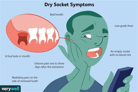 Dry Socket Causes Symptoms Diagnosis Treatment