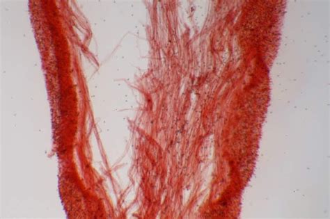 El mundo microscópico de los hongos: Pholiota gummosa var. rufobrunnea P. Karst