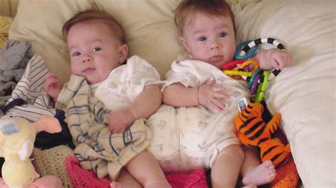 Colorados Conjoined Twins 14 Years Later