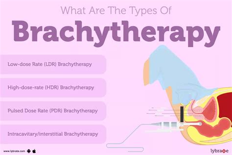 Brachytherapy Causes Symptoms Treatment And Cost