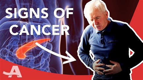 Pancreatic cancer survival rate (in the uk). Early Signs of Pancreatic Cancer - YouTube