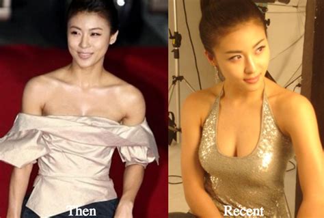 Ha Ji Won Breast Implants Surgery Rumors Before And After Latest