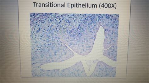 Solved Transitional Epithelium 400x