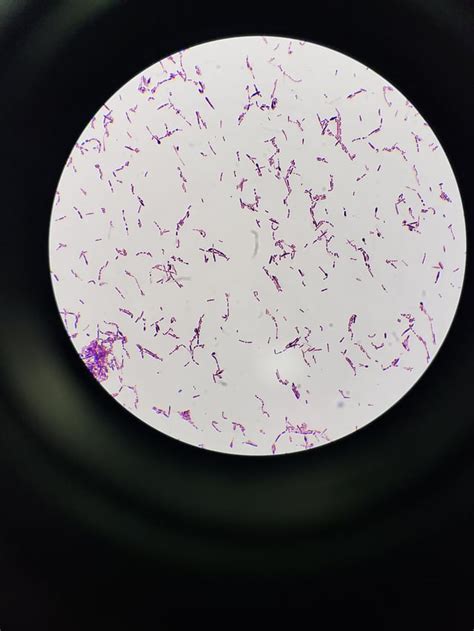 Curious What This Might Be Rmicrobiology