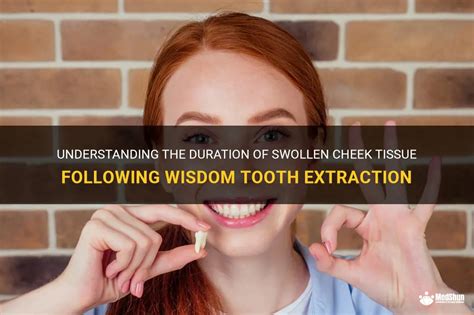 Understanding The Duration Of Swollen Cheek Tissue Following Wisdom