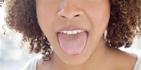 What Causes Geographic Tongue The Mysterious Taste Bud Condition