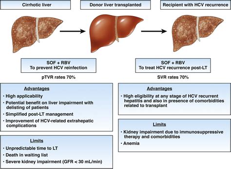 Sofosbuvir Treatment In The Pre And Post Liver Transplantation Phase